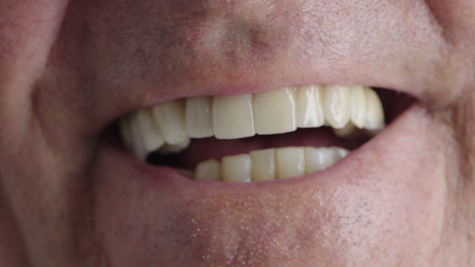 videoblocks-close-up-of-elderly-man-mouth-laughing-healthy-teeth_rxgqrwgav7_thumbnail-full01